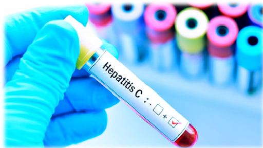 hepatitis